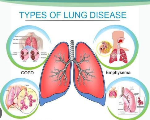 Respiratory Disease Treatment