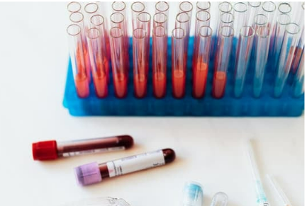 Complete Blood Count (CBC)
