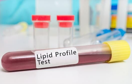 Lipid Profile