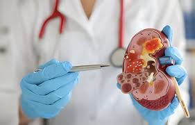 Comprehensive Kidney Care: